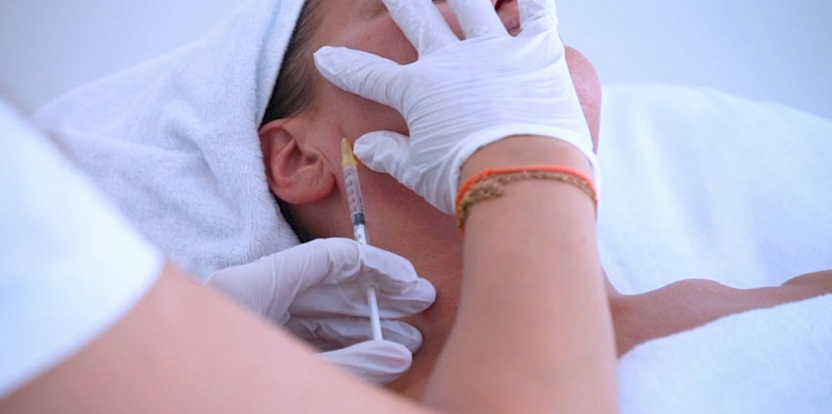 Littekenbehandeling door Mesotherapie bij Giselene Oisterwijk